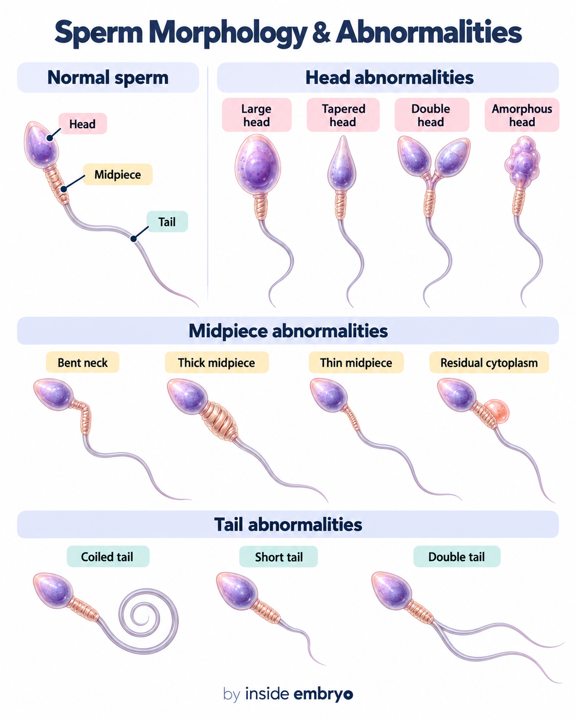 Educational infographic showing sperm morphology and abnormalities