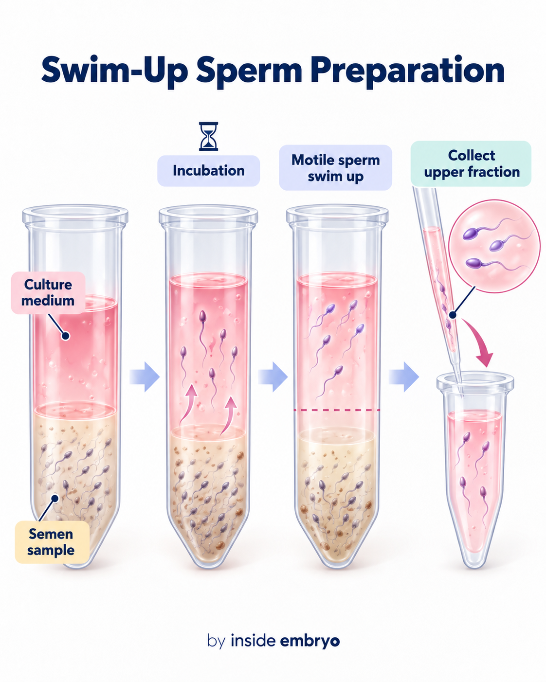 Educational infographic explaining swim-up sperm preparation
