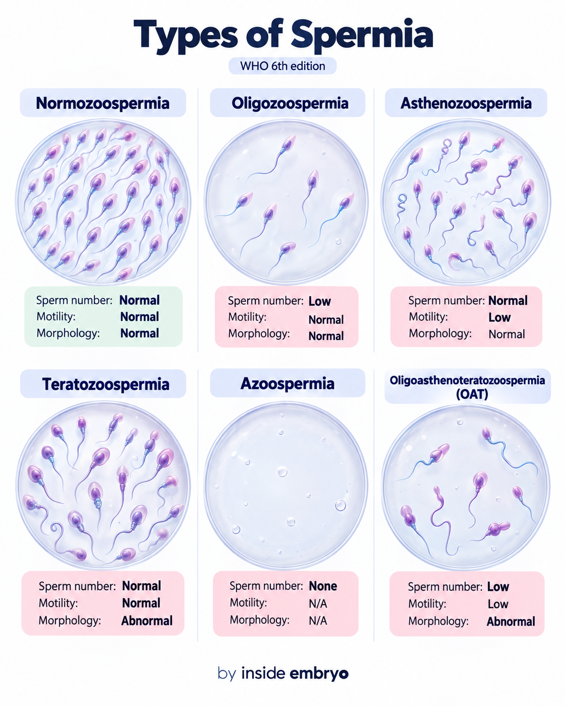Educational visual comparison of semen terminology including oligozoospermia and azoospermia